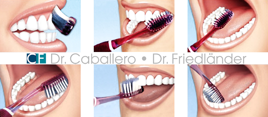 cepillado-dental_clinica-CF-Barcelona